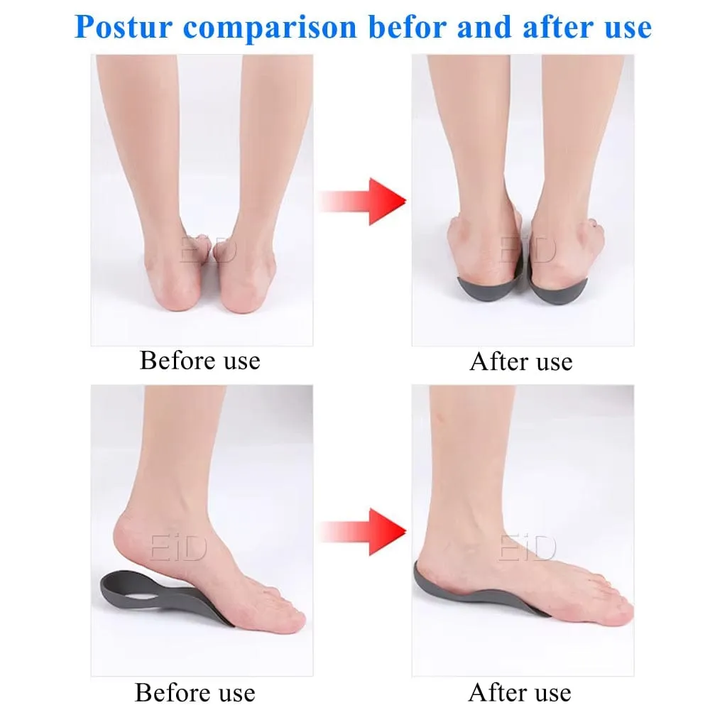 XO-Legs™ Orthopedic Insoles – Step Into Comfort, Say Goodbye to Foot Pain!