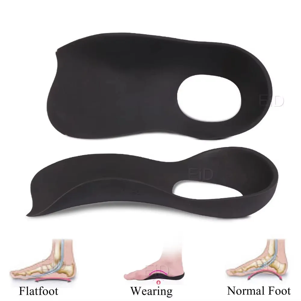 XO-Legs™ Orthopedic Insoles – Step Into Comfort, Say Goodbye to Foot Pain!