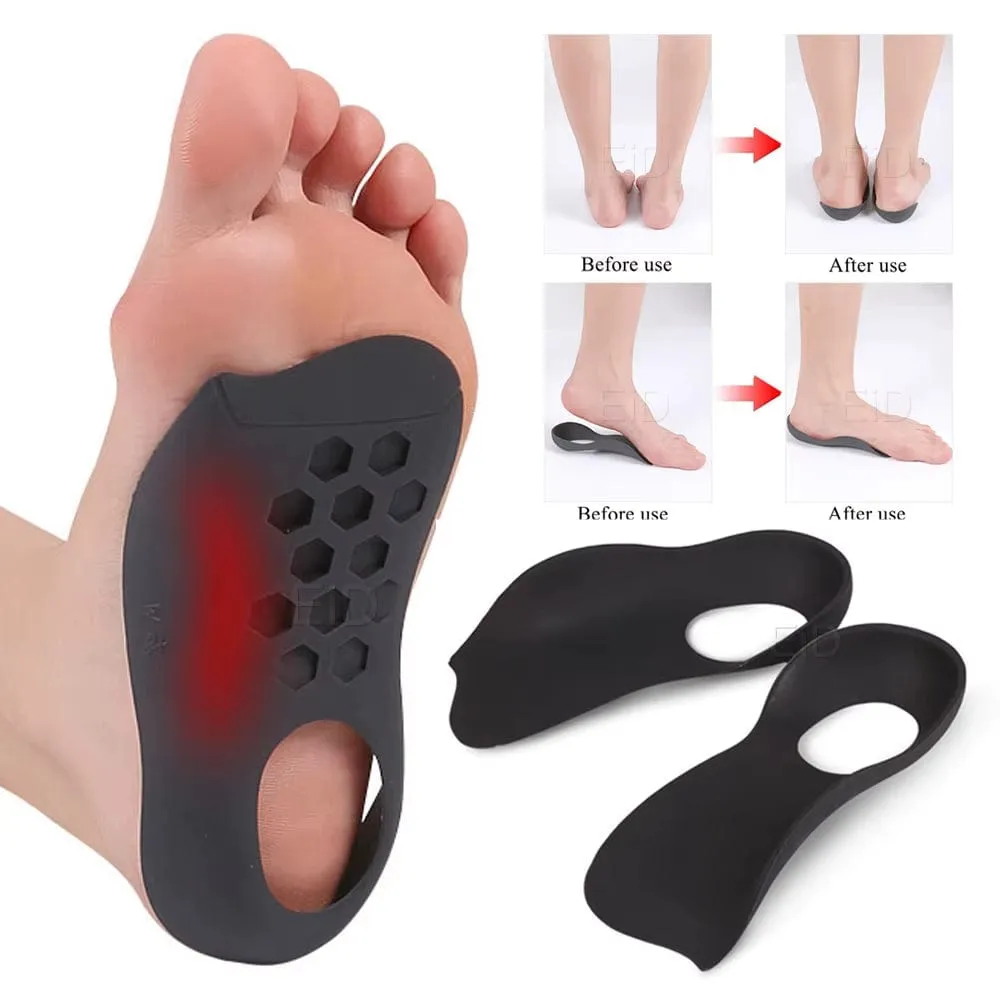 XO-Legs™ Orthopedic Insoles – Step Into Comfort, Say Goodbye to Foot Pain!